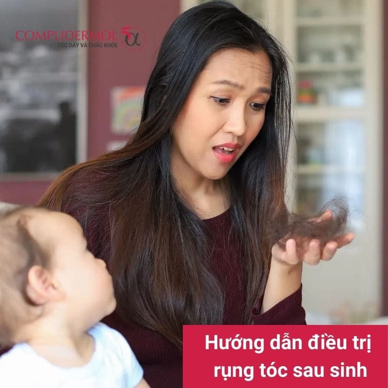 Hướng dẫn điều trị rụng tóc sau sinh